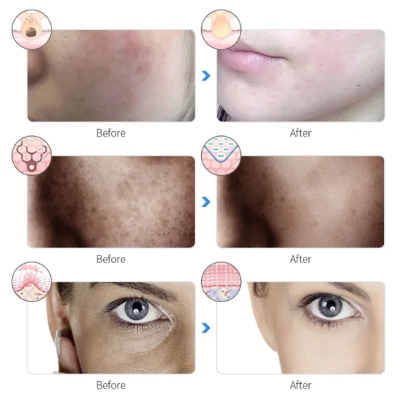 DAngelsOn Celestial Glow Face - Boost collagen production, promoting natural skin regeneration and repair - Image 5